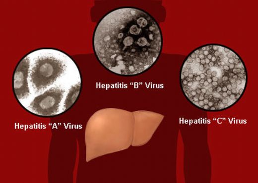 Akut-Hepatit-19