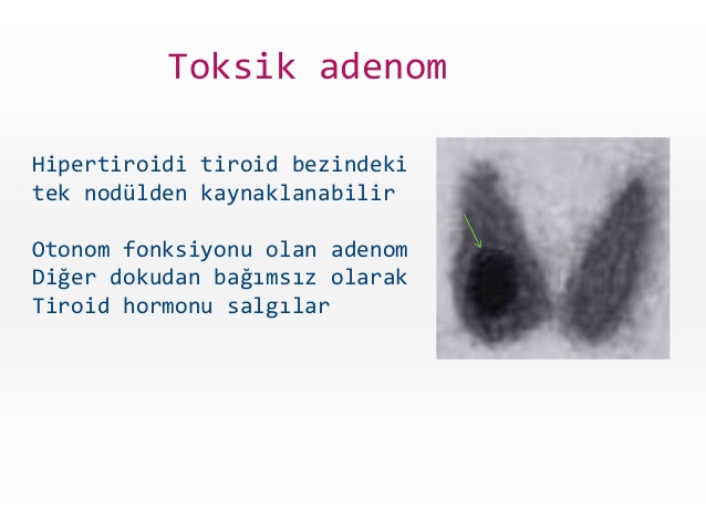 tiroid-hastalklar-genel-bak-di-hekimlii-dersi-25-638