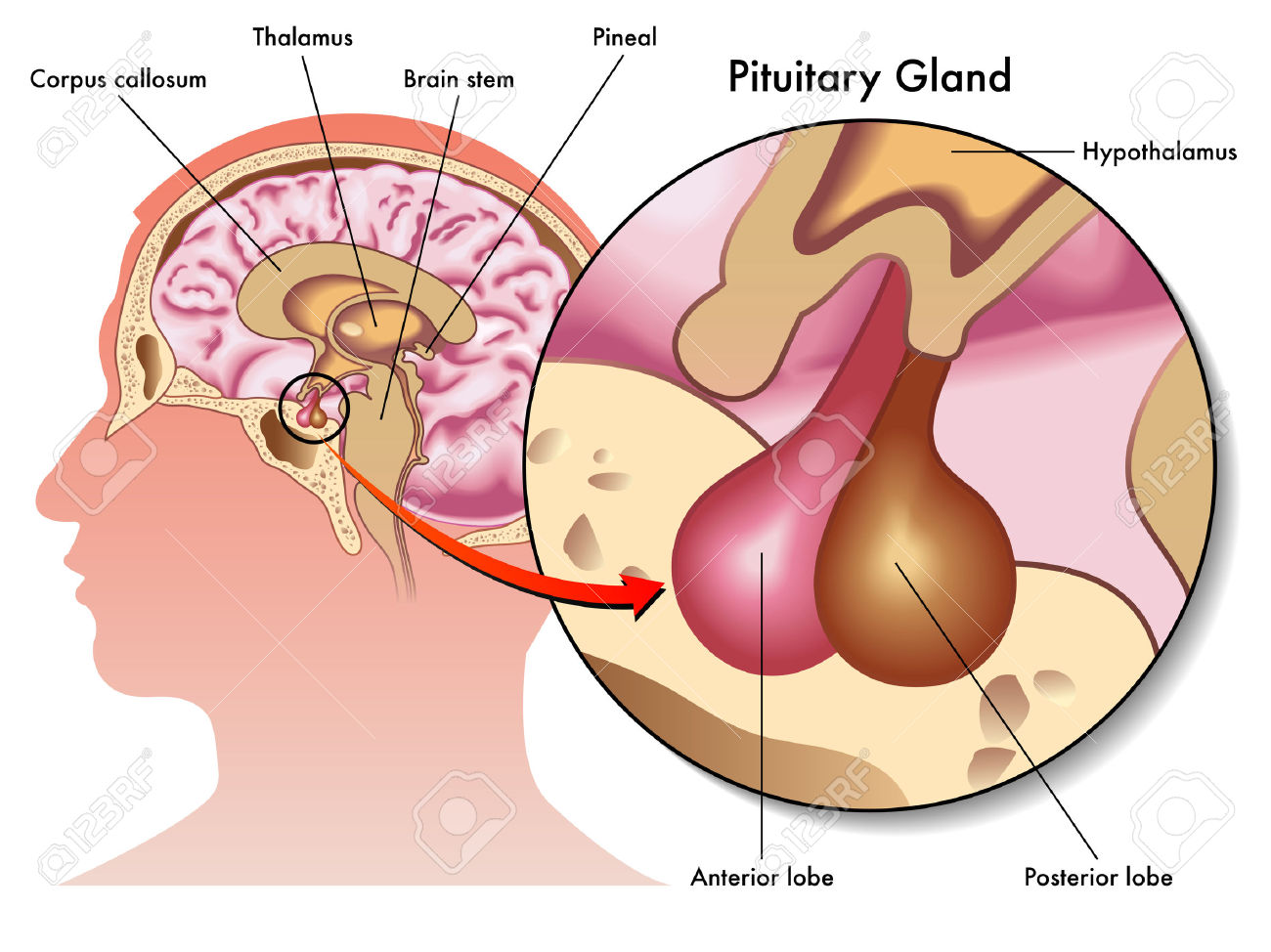 32045490-pituitary-gland-Stock-Photo