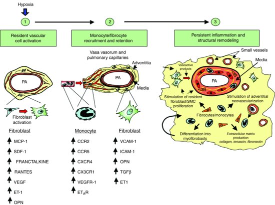 Figure-4-Essential-role-of-the-adventitial-fibroblast-in-initiating-and-perpetuating